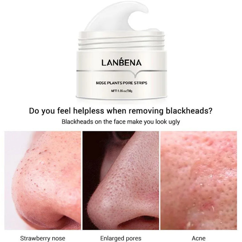 Nose Blackhead Remover Cream P - Skincare Natur E review and price