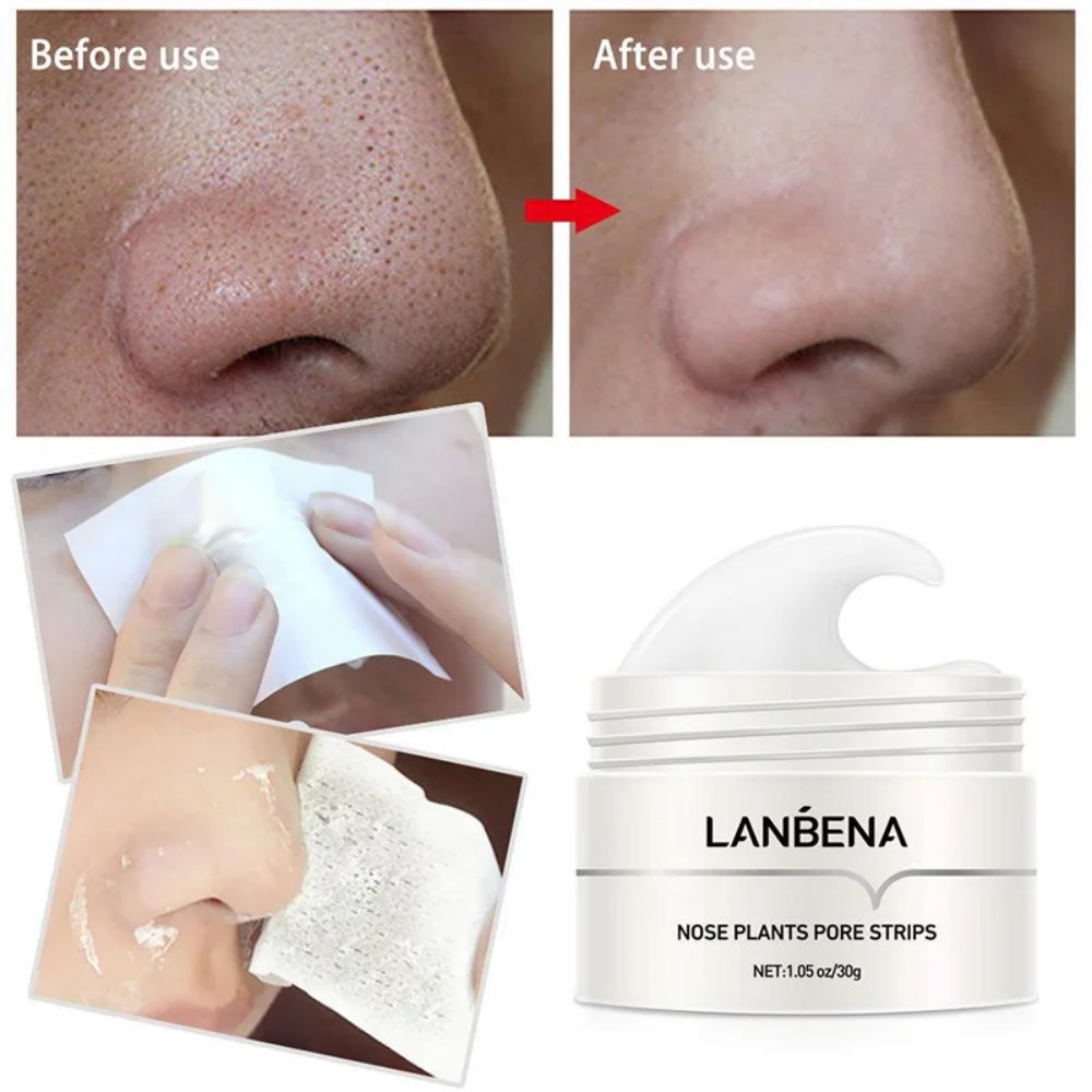 Nose Blackhead Remover Cream P - Skincare Natur E review and price